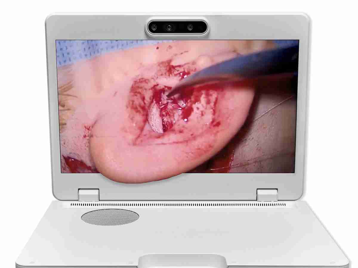 达擎之＂Heads-up 3D显微手术显示系统＂，，，，整合4K裸眼3D显示及眼球追踪系统，，，，具备快速追踪人眼移动位置功能，，减轻医师长时间维持固定姿势的负担，，，，让医师能有更宽广清晰的3D立体视野及更舒适的姿势来执行手术。。。